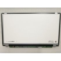 LG 15.6