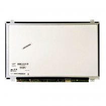 LG 15.6