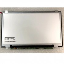 LG 15.6